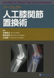 パーフェクト 人工膝関節置換術