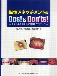 磁性アタッチメントのDos! & Don'ts!