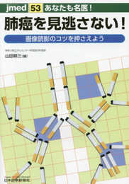 あなたも名医! 肺癌を見逃さない! 画像読影のコツを押さえよう (jmed 53)