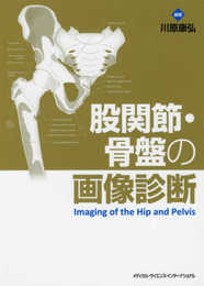 股関節・骨盤の画像診断