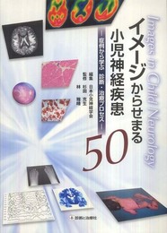 イメージからせまる小児神経疾患50