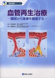 血管再生治療