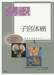 子宮体癌 (腫瘍病理鑑別診断アトラス)