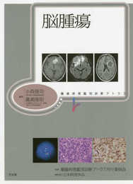 脳腫瘍 (腫瘍病理鑑別診断アトラス)