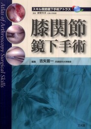 膝関節鏡下手術