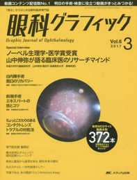 眼科グラフィック 2017年3号(第6巻3号)特集:白内障手術 脱臼のリカバリー / 斜視手術エキスパートの技とコツ / ちょっとこだわりのある コンタクトレンズトラブルの対処法