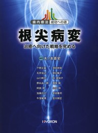歯内療法 成功への道 根尖病変: 治癒へ向けた戦略を究める