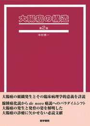 大腸癌の構造