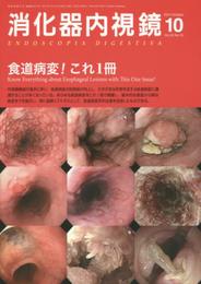 消化器内視鏡 14年10月号 26-10