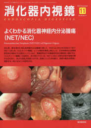 消化器内視鏡第28巻11号 よくわかる消化器神経内分泌腫瘍(NET/NEC)