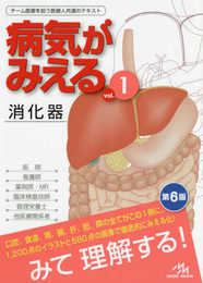 病気がみえる vol.1 消化器 第6版