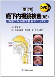 実践嚥下内視鏡検査(VE): 動画でみる嚥下診療マニュアル
