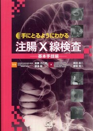 注腸X線検査?基本手技編? (手にとるようにわかる)