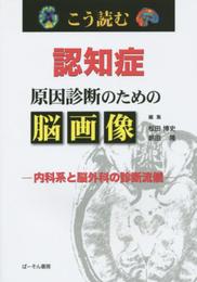こう読む認知症原因診断のための脳画像: 内科系と脳外科の診断流儀