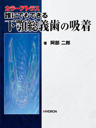 誰にでもできる下顎総義歯の吸着
