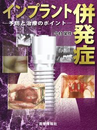 インプラント併発症: 予防と治療のポイント