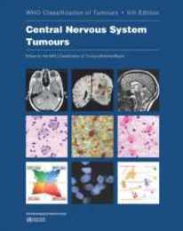 Central Nervous System Tumours (WHO Classification of Tumours 6)