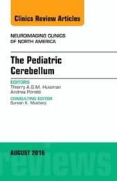 The Pediatric Cerebellum An Issue of Neuroimaging Clinics of North America (Volume 26-3) (The Clinics: Radiology Volume 26-3)
