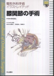 膝関節の手術 (整形外科手術イラストレイテッド)