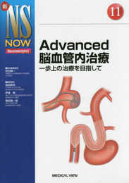 Advanced脳血管内治療?一歩上の治療を目指して (新NS NOW 11)