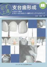 必ず上達　支台歯形成 (必ず上達シリーズ)