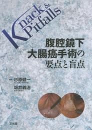 腹腔鏡下大腸癌手術の要点と盲点 (Knack & pitfalls)