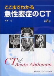 ここまでわかる急性腹症のCT 第2版