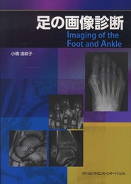 足の画像診断