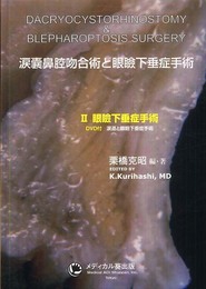涙嚢鼻腔吻合術と眼瞼下垂症手術 2
