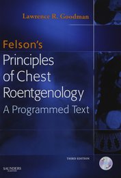 Felson's Principles of Chest Roentgenology Text with CD-ROM 3e