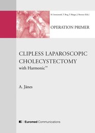 Clipless Laparoscopic Cholecystectomy with Harmonic