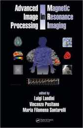 Advanced Image Processing in Magnetic Resonance Imaging (Signal Processing and Communications)