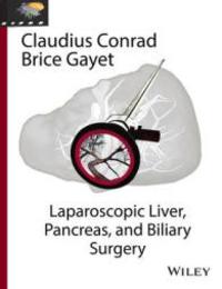 Laparoscopic Liver Pancreas and Biliary Surgery: Video Atlas Included