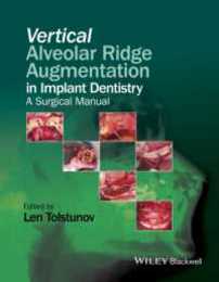 Vertical Alveolar Ridge Augmentation in Implant Dentistry: A Surgical Manual