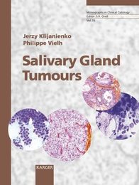 Salivary Gland Tumours: Monographs in Clinical Cytology