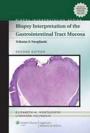 Biopsy Interpretation of the Gastrointestinal Tract Mucosa Neoplastic Vol. 2 (Biopsy Interpretation Series)