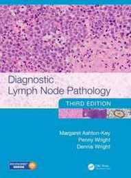 Diagnostic Lymph Node Pathology
