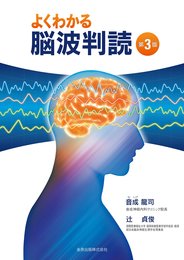 よくわかる脳波判読 第3版