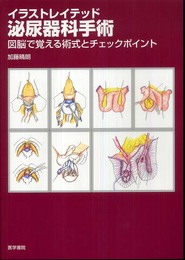 イラストレイテッド泌尿器科手術―図脳で覚える術式とチェックポイント