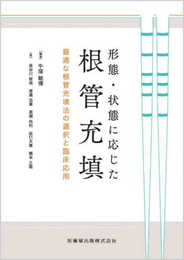 形態・状態に応じた根管充填: 最適な根管充填法の選択と臨床応用