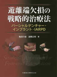 遊離端欠損の戦略的治療法 パーシャルデンチャー・インプラント・IARPD