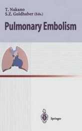 Pulmonary embolism