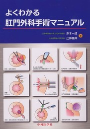 よくわかる肛門外科手術マニュアル