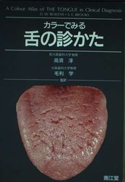カラーでみる舌の診かた