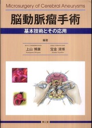 脳動脈瘤手術
