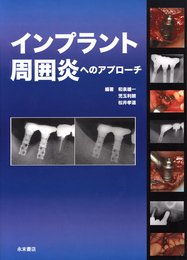 インプラント周囲炎へのアプローチ