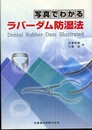 写真でわかるラバーダム防湿法