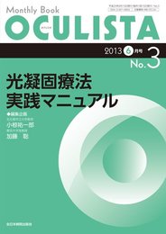 光凝固療法実践マニュアル (MB OCULISTA (オクリスタ))