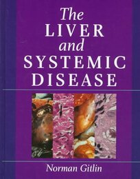The Liver and Systemic Disease