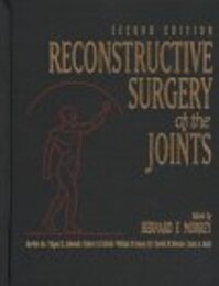 Reconstructive Surgery of the Joints